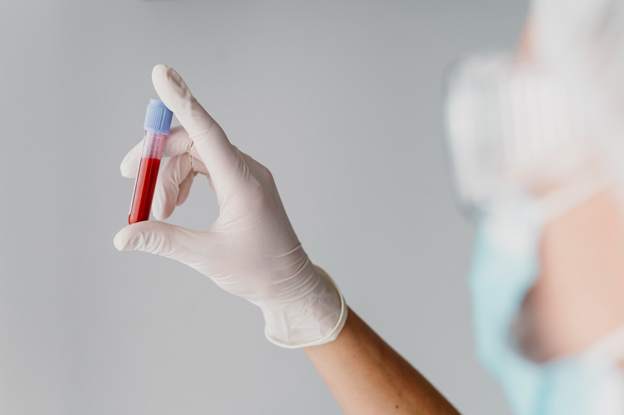 Novas metas de colesterol em 2025: valores mais rígidos para proteger seu coração 