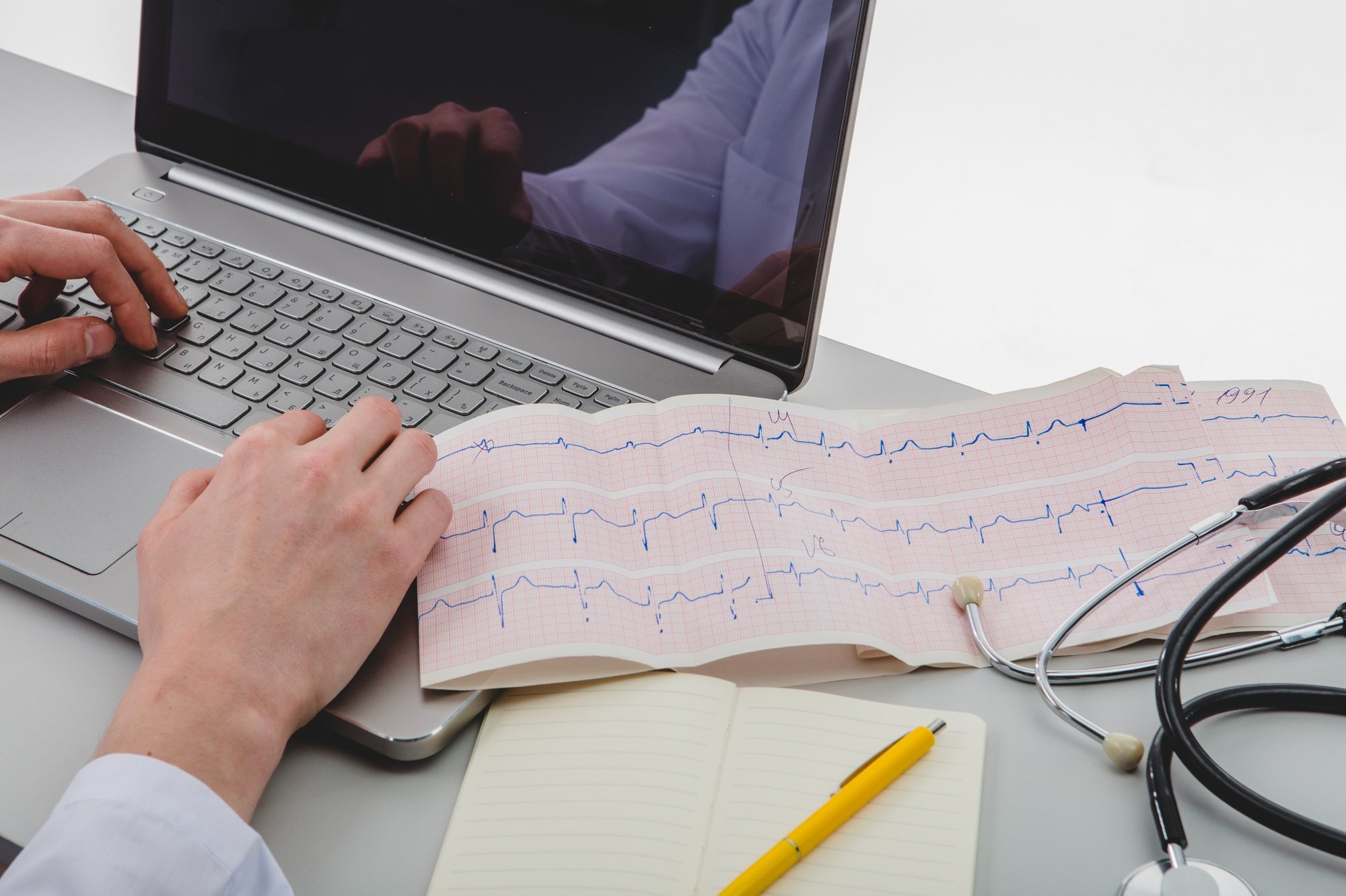 Eletrocardiograma: entenda para que serve e quem deve fazer o exame 