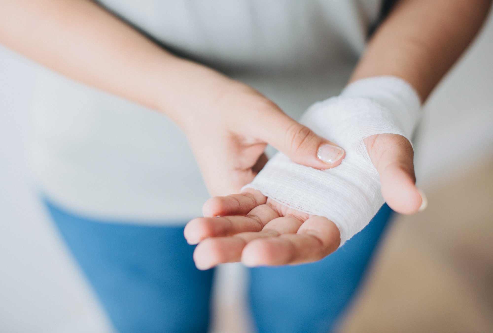 Queimaduras: causas, tipos e o que fazer em cada situação 