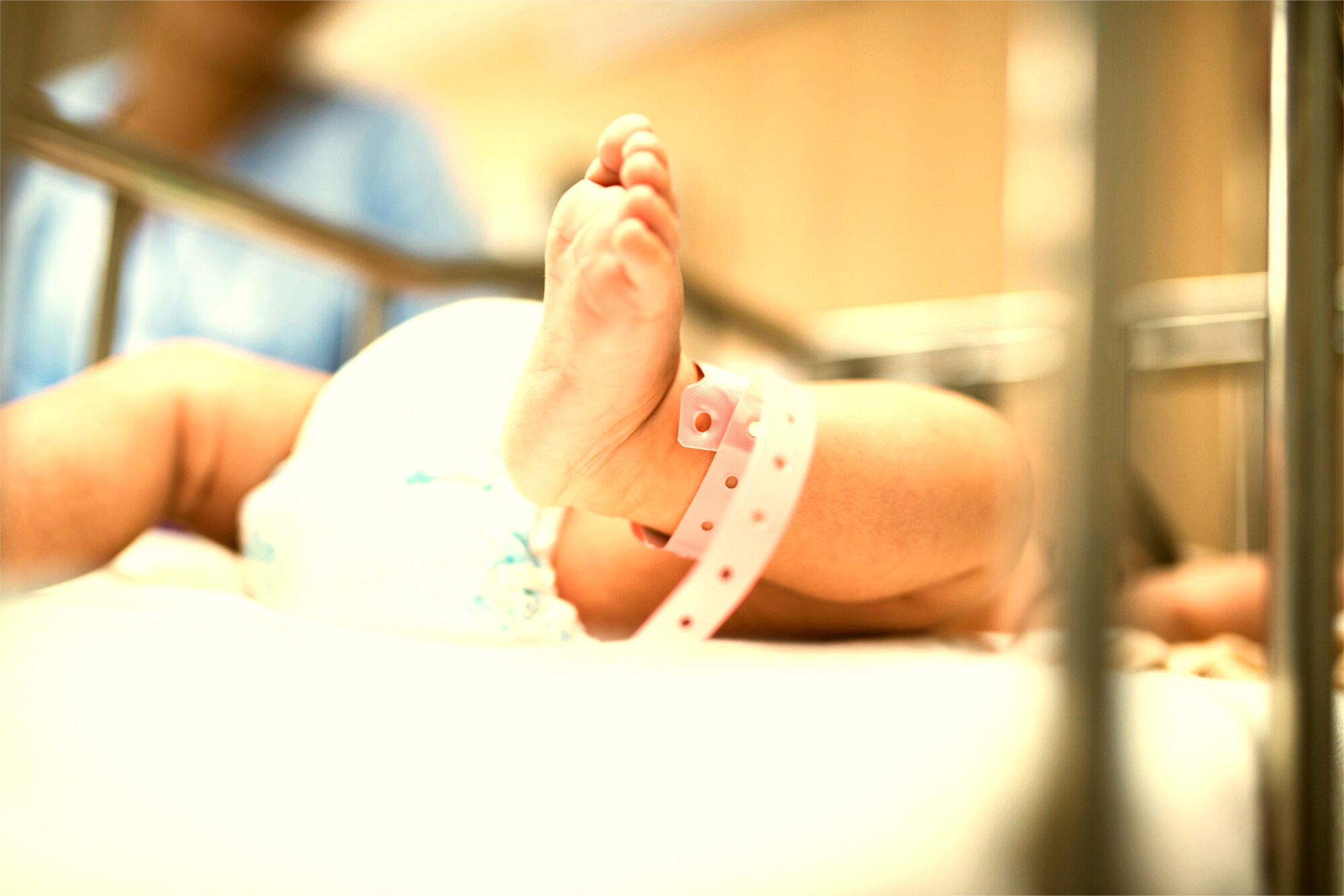 Bebê recém-nascido em berço com icterícia neonatal