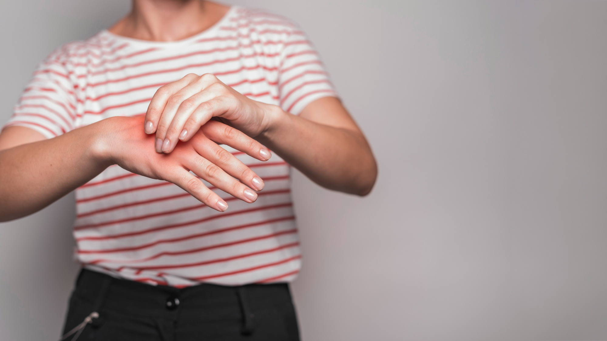 Mulher com camiseta branca com listras vermelhas aperta a mão demonstrando a inflamação provocada pela artrite reumatoide.
