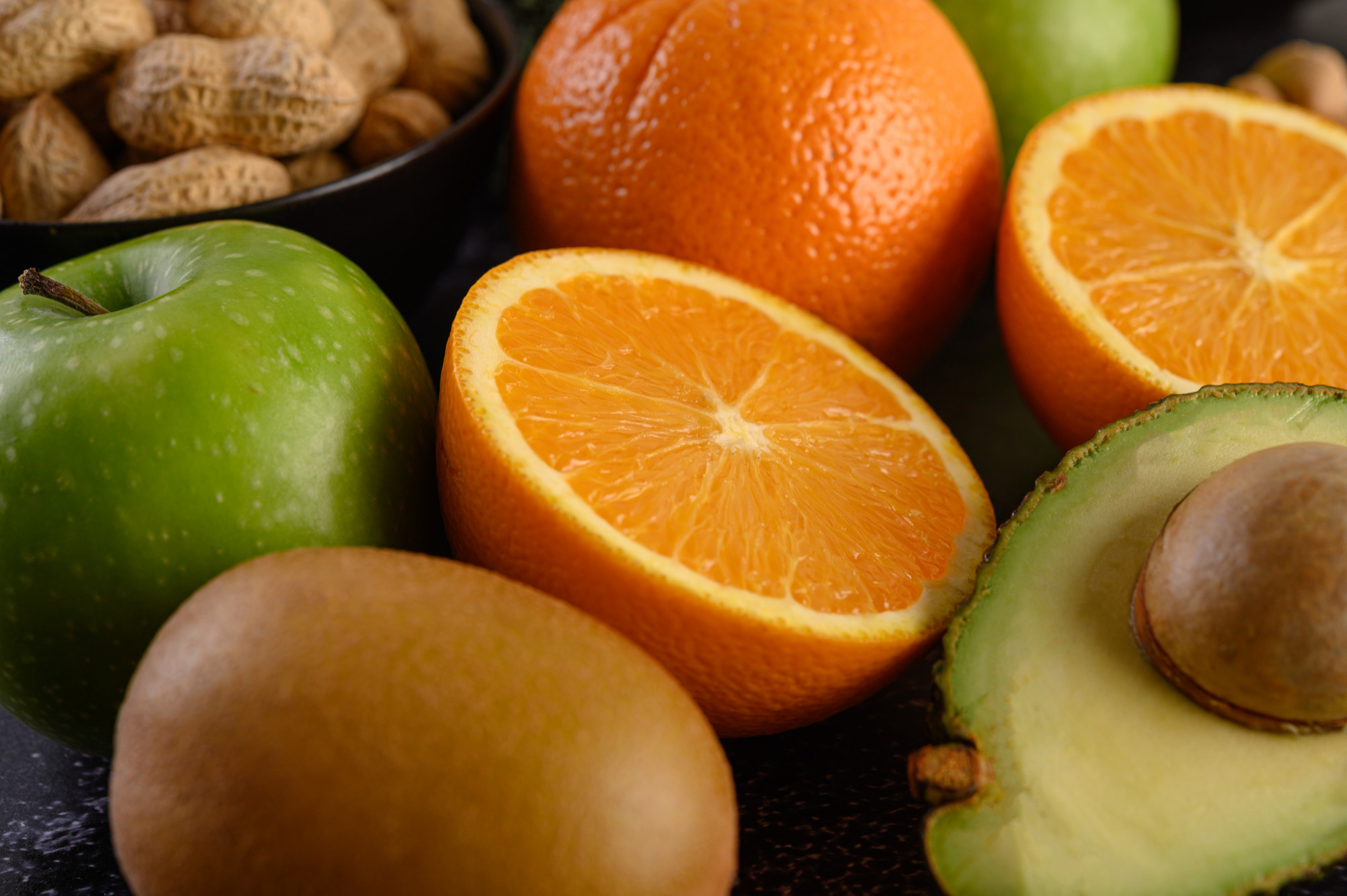 Alimentos fontes de vitamina C, que previne escorbuto: laranja, kiwi, abacate.