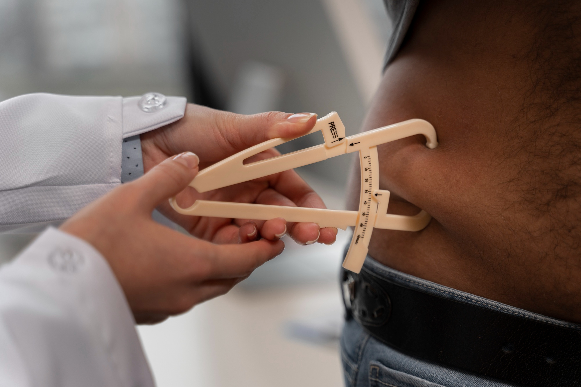 Profissional de saúde medindo dobra cutânea na região abdominal para avaliar gordura corporal, em contexto de acompanhamento da obesidade.