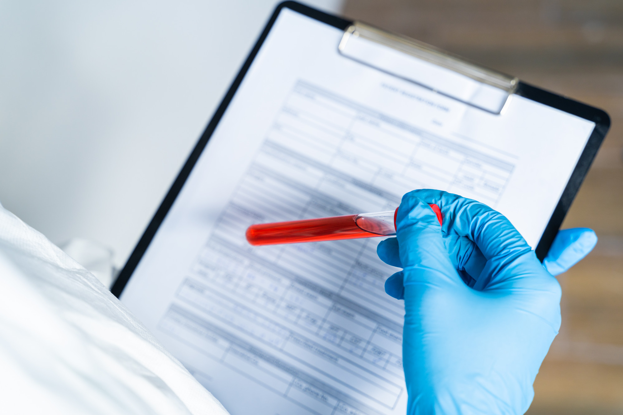 Exame de sangue mostrando aumento dos leucócitos no hemograma, representando leucocitose e suas possíveis causas.