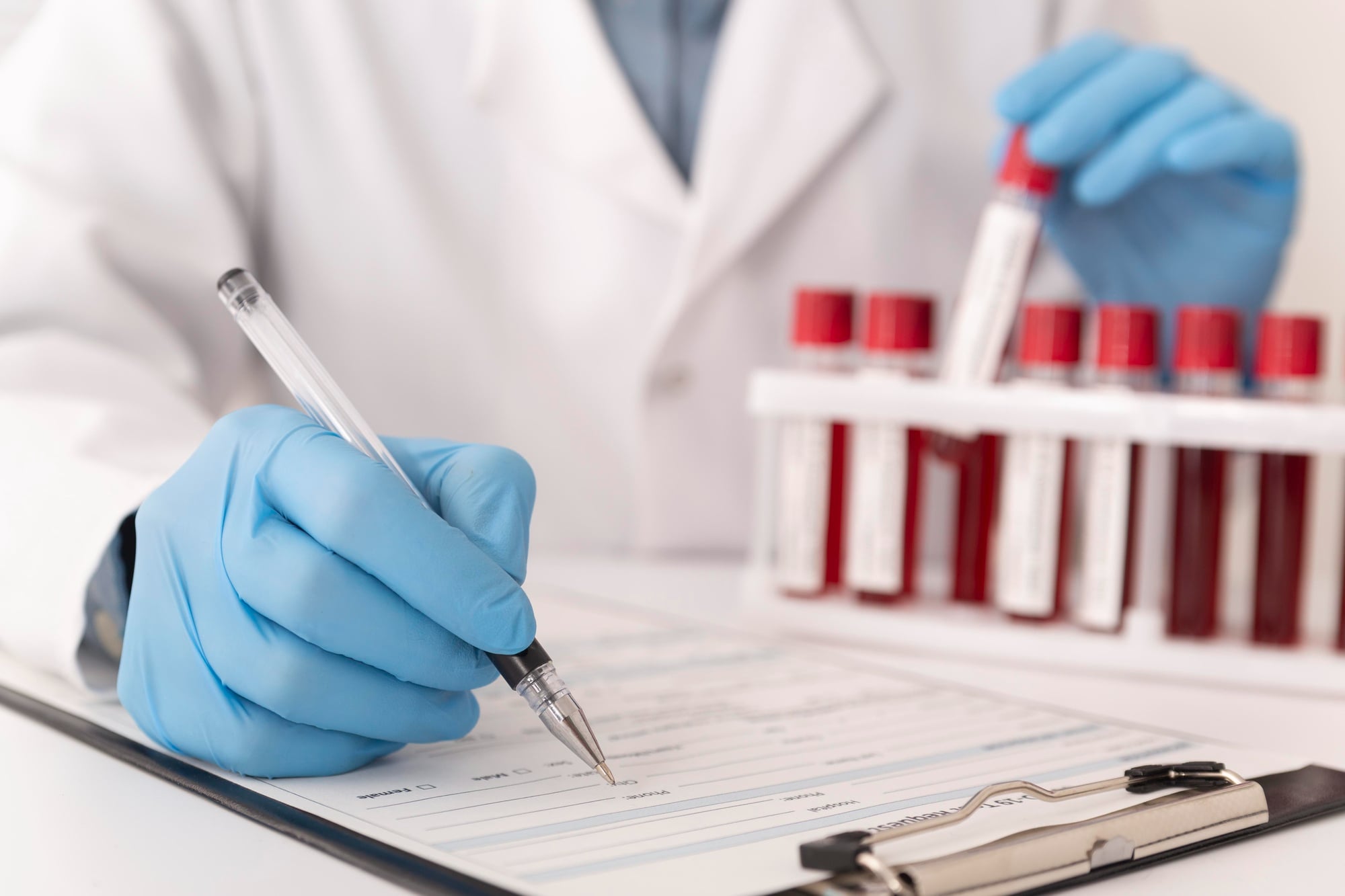 Profissional de saúde analisando resultados de exames de sangue com os níveis de sódio e potássio.